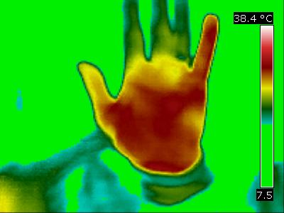 Infrared of Sorefinger